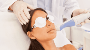laser skin resurface