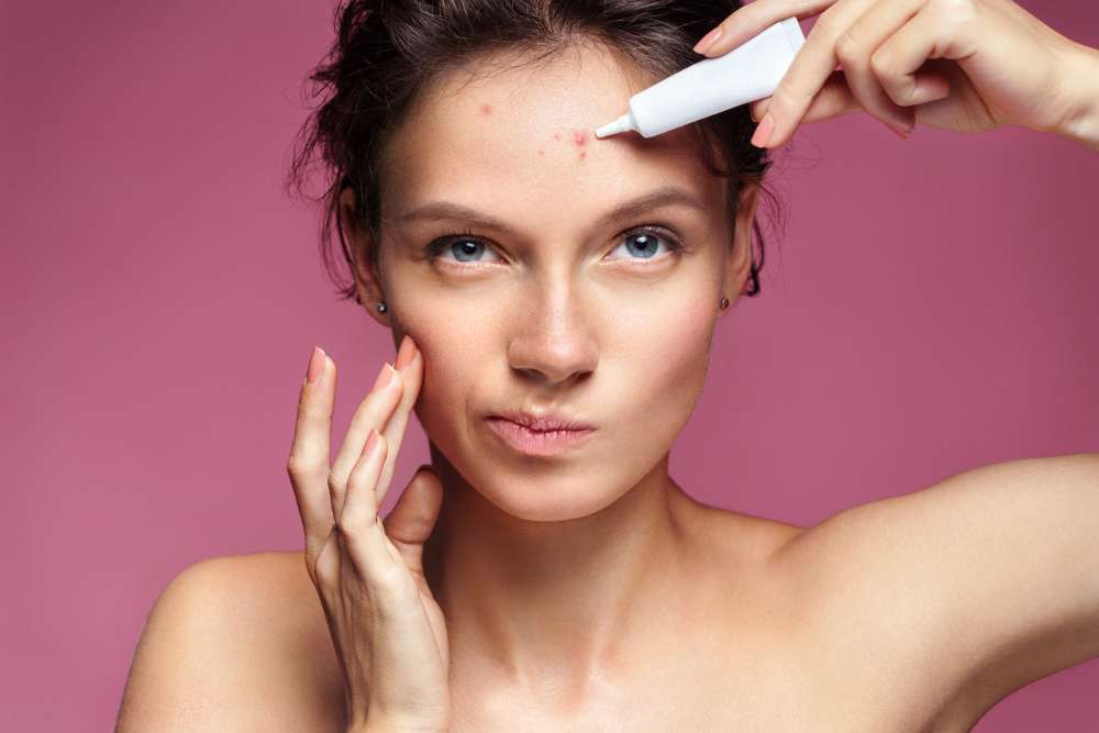 woman with forehead acne