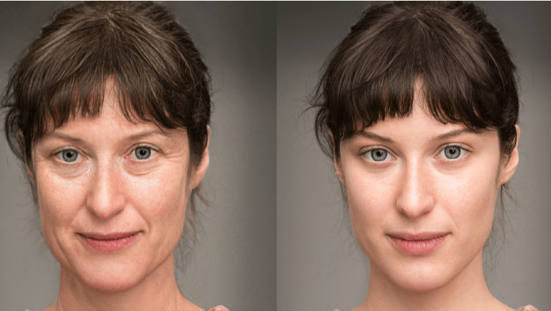 before and after