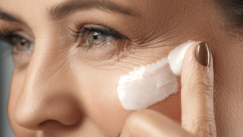 how to treat crows feet