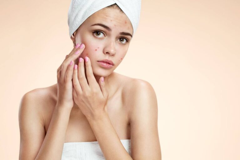 Young woman with a towel wrapped around her head, gently touching her face, which shows signs of acne. She has a neutral expression, highlighting her concern for skin health. The background is a soft gradient of warm colors, creating a calming atmosphere. This image represents skincare, beauty routines, and the importance of addressing skin issues. The focus on the woman&apos;s hands and face emphasizes self-care and the challenges of maintaining clear skin.