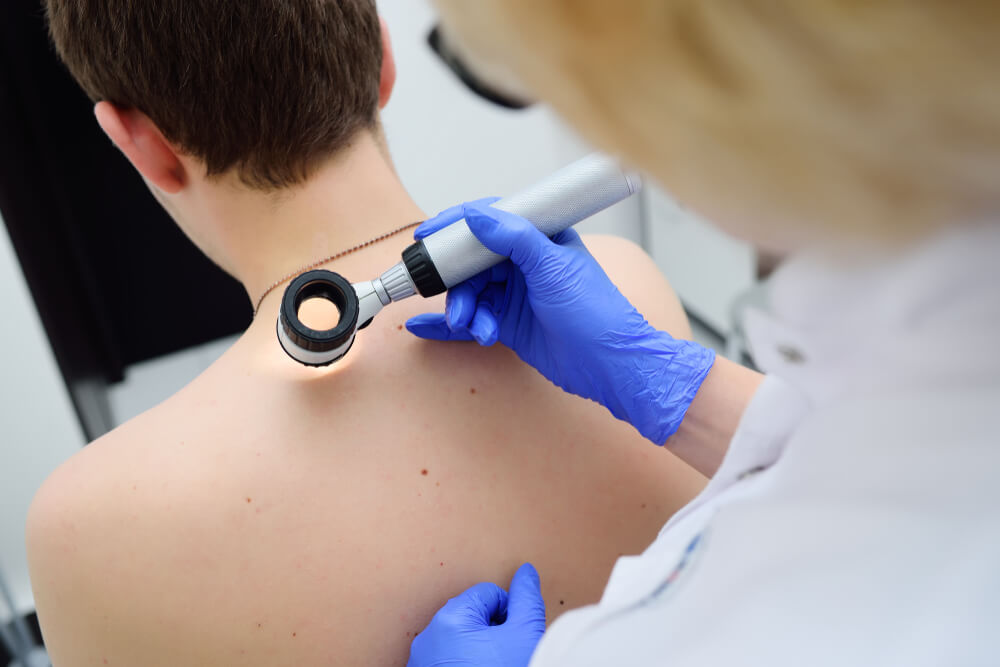 A healthcare professional wearing blue gloves examines a patient&apos;s back using a dermatoscope, a tool designed for skin assessment. The patient, whose back is partially visible, is undergoing a skin examination, possibly for moles or other skin conditions. The setting appears to be a medical office, emphasizing the importance of regular skin checks for early detection of skin issues. This image highlights the role of dermatological assessments in maintaining skin health.