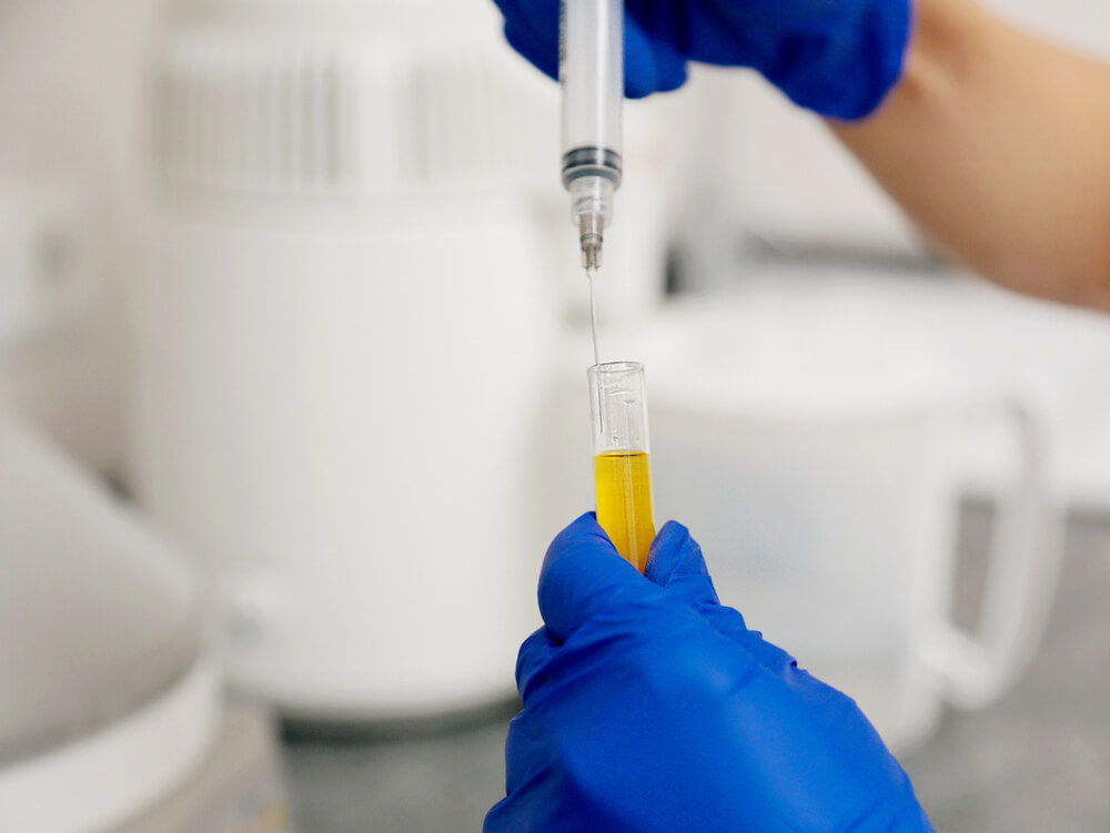 A laboratory technician in blue gloves holds a syringe above a test tube filled with yellow liquid, preparing to transfer the liquid. The background features laboratory equipment, creating a clinical environment. This image illustrates the process of sample handling and analysis in a scientific setting, emphasizing precision and safety in laboratory practices.