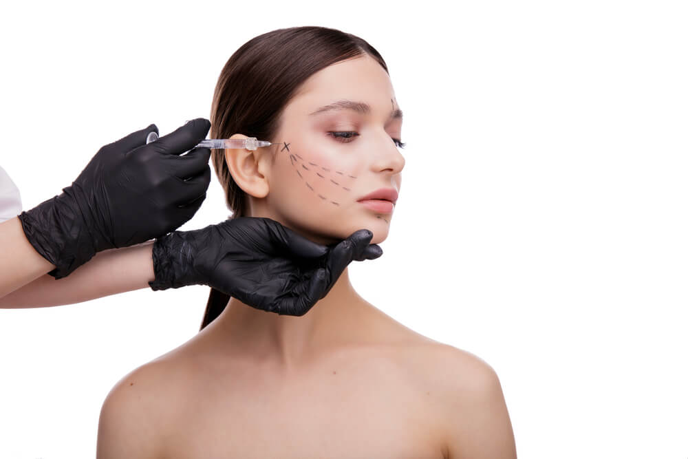 Dermal fillers on cheek
