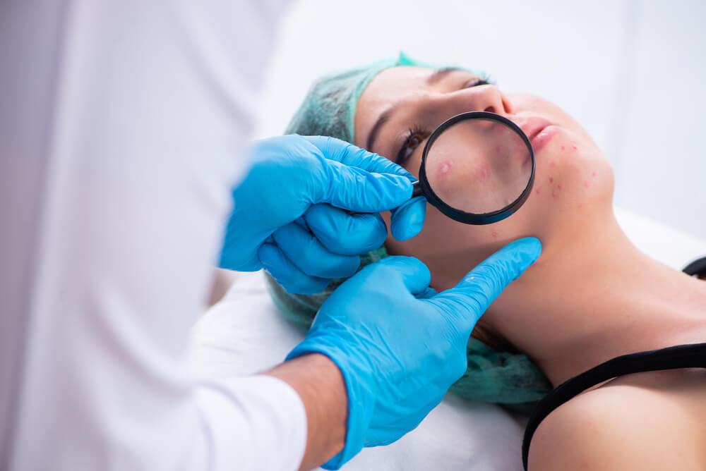 dermatologist checking patients acne