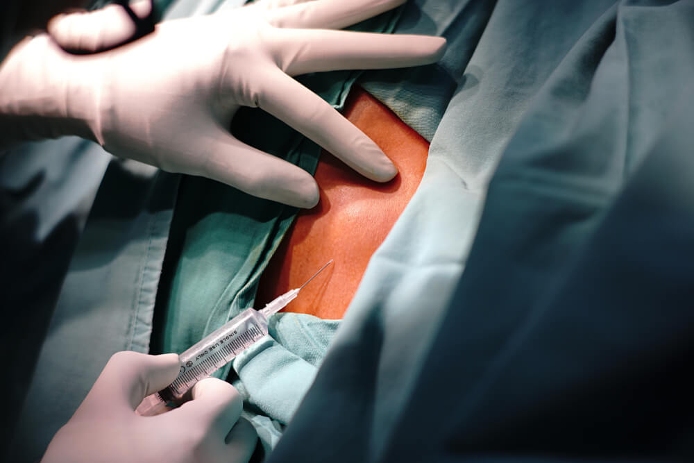 doctor operating cyst of a patient