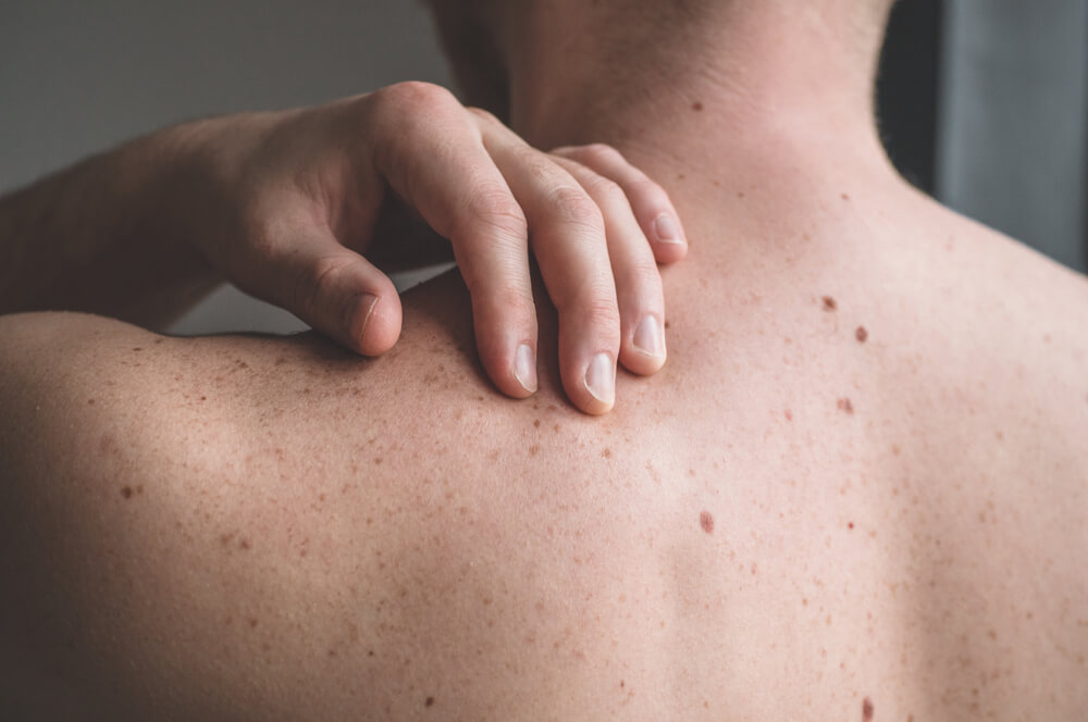 Close-up image of a person&apos;s back showing a hand gently touching the shoulder area. The skin is lightly freckled, highlighting natural textures. This image conveys themes of relaxation, body awareness, and self-care. Suitable for discussions on skin health, massage techniques, or wellness practices.