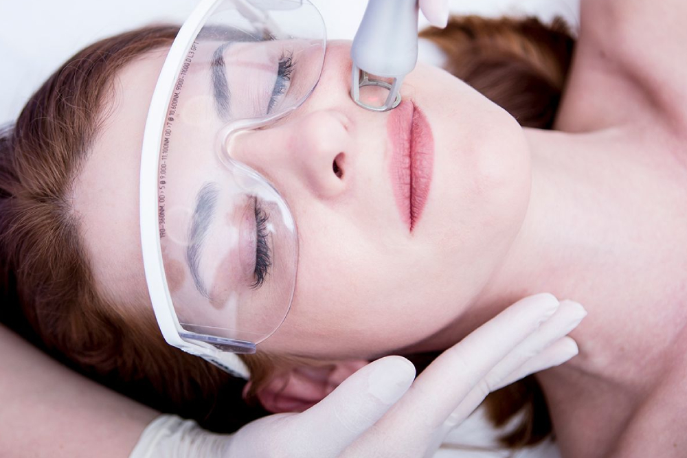 CO2 laser resurfacing