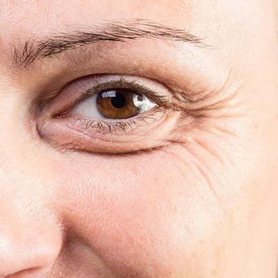 Close-up of a woman&apos;s eye showing fine lines and wrinkles around the outer corner, highlighting signs of aging. The eye is brown with a clear iris, and the skin texture is visible, emphasizing the natural beauty and character of the face. This image can be used to discuss topics related to skincare, aging, and beauty treatments.