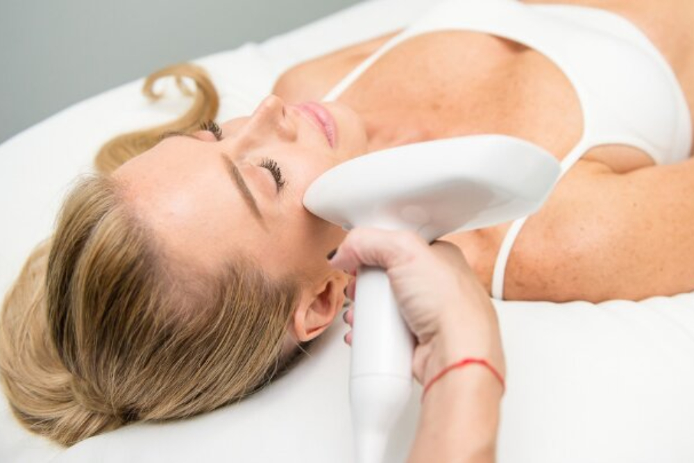 Fractional laser resurfacing