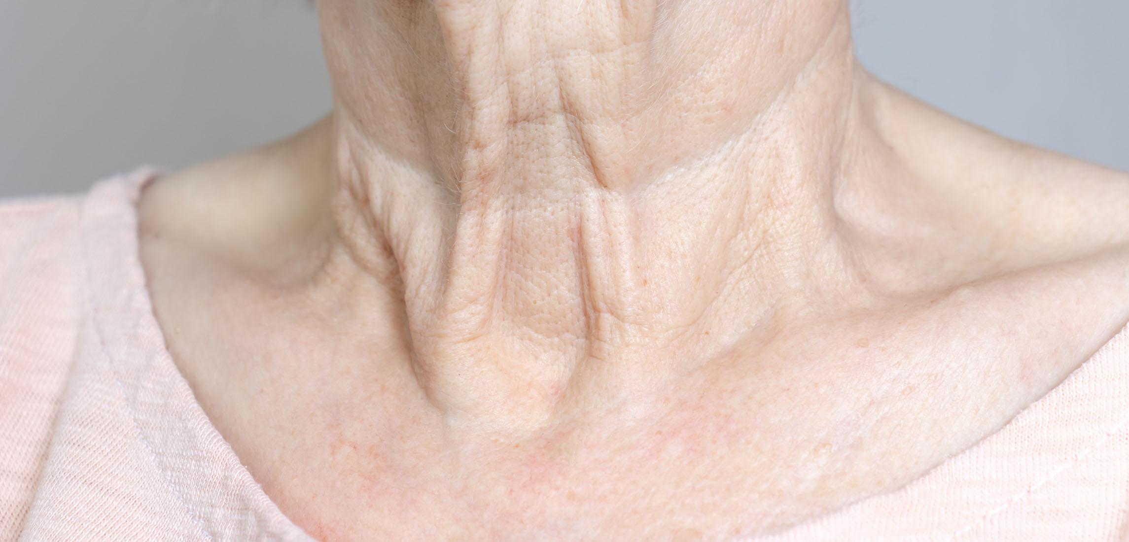 Close-up image of an elderly person&apos;s neck and collarbone area, showcasing fine lines and skin texture. The skin appears delicate and slightly wrinkled, reflecting signs of aging. The individual is wearing a soft pink top, adding a gentle contrast to the skin tone. The background is neutral, allowing focus on the skin details. This image highlights the natural aging process and can be relevant for discussions on skincare, aging, or dermatology.