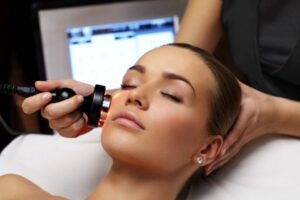 laser resurfacing - Team Dermatology