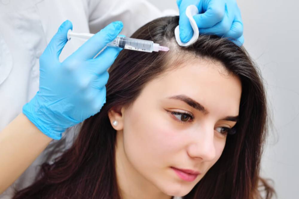 A healthcare professional in blue gloves administers a hair restoration treatment to a young woman. The procedure involves using a syringe to inject a solution into the scalp, targeting areas of hair thinning. The woman appears calm and focused, with her hair partially pulled back, revealing the treatment area. This image highlights the growing trend of non-surgical hair restoration techniques aimed at improving hair density and overall scalp health.