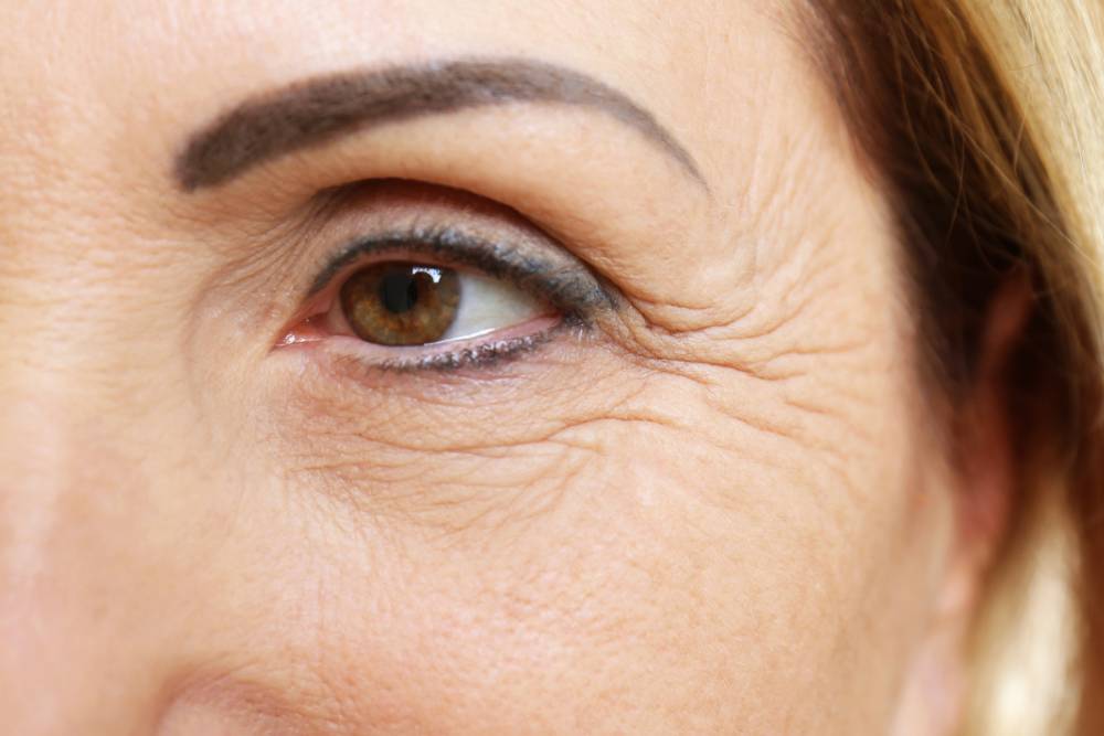 Skin Tightening for Lines & Wrinkles