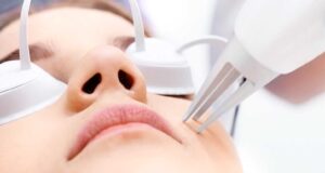 EUC INT Aquaphor Laser treatment 00 header - Team Dermatology
