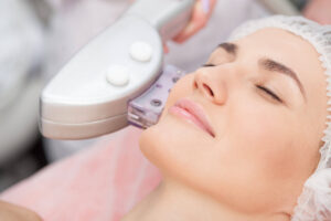 Fractional Laser Pearl - Team Dermatology