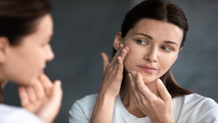 dry-skin-woman