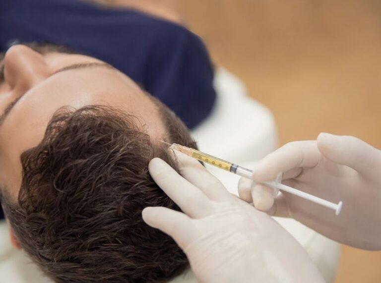 hair loss doctor makes injections in the man&apos;s head to manage hair loss and baldness