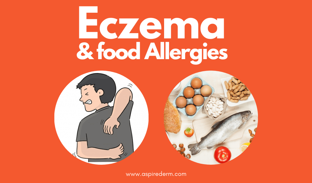 The Link Between Diet & Eczema - Team Dermatology