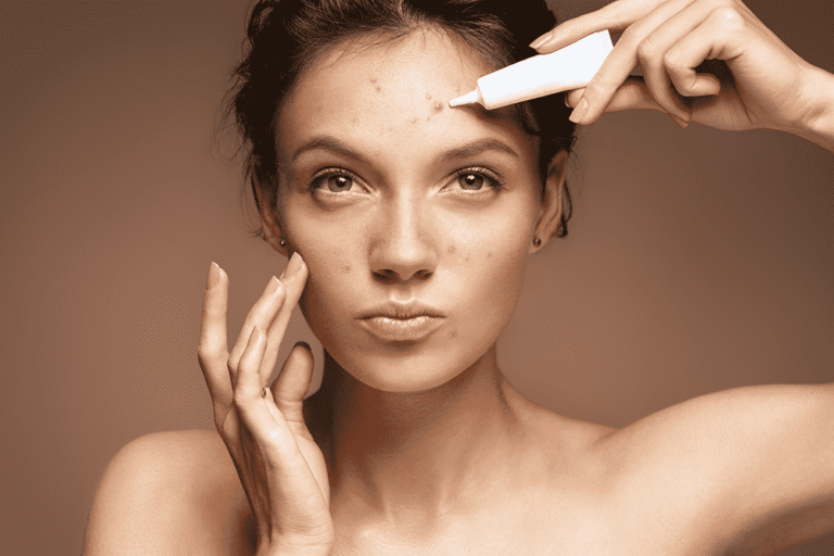 get rid of forehead acne