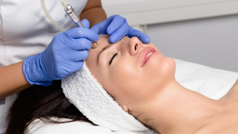 What is microdermabrasion