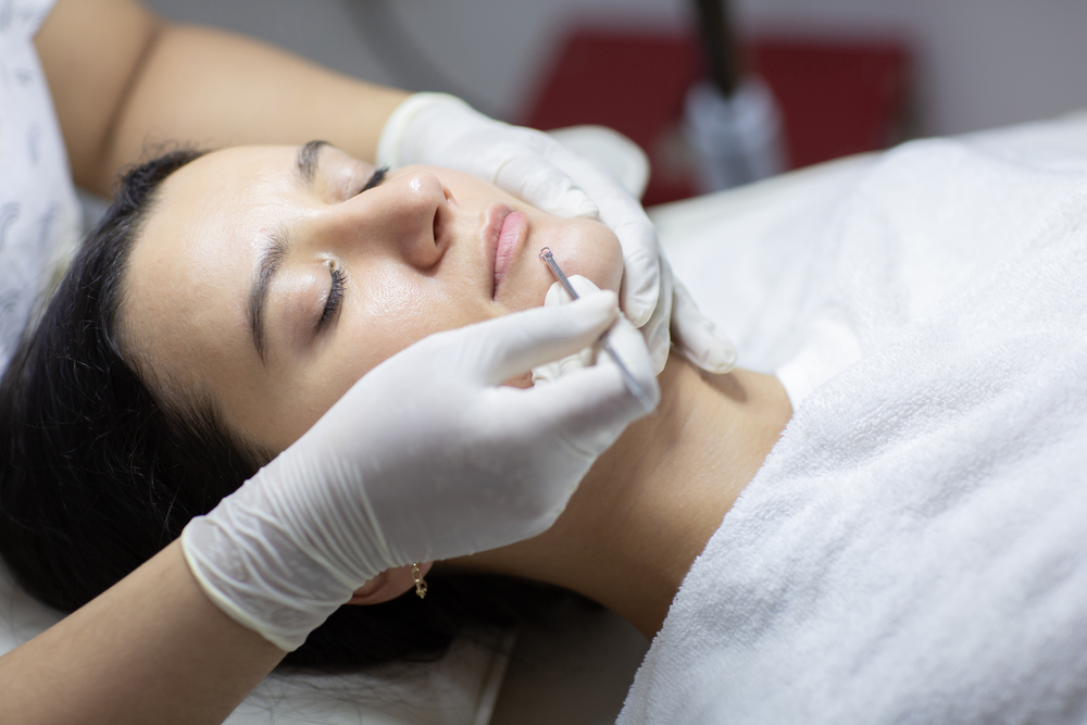 women under going acne treatment