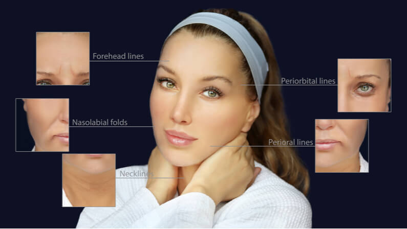 what do dermal fillers do