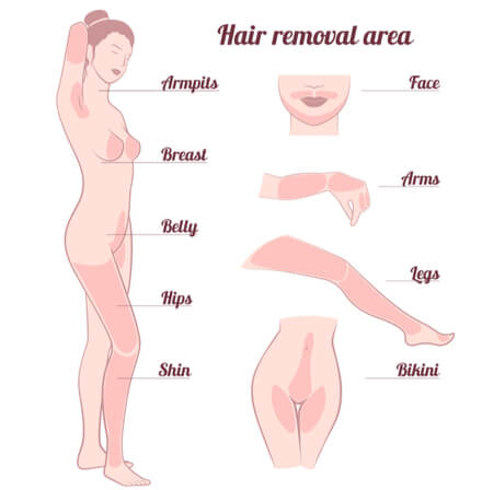 Which hair removal treatment areas hurt the worst_