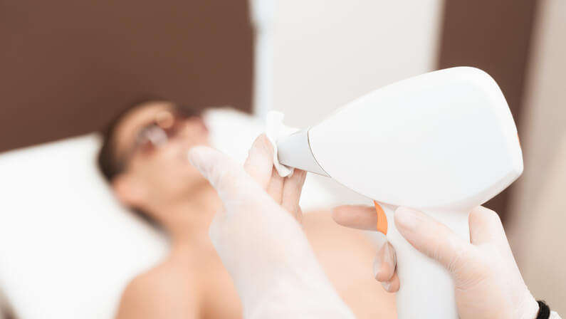 how laser hair removal works.