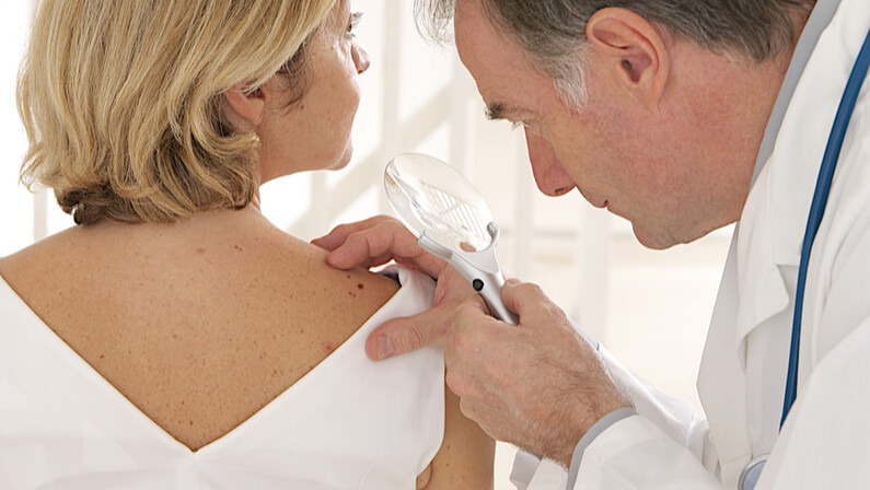 a doctor diagnosing a patient for a potential skin cancer