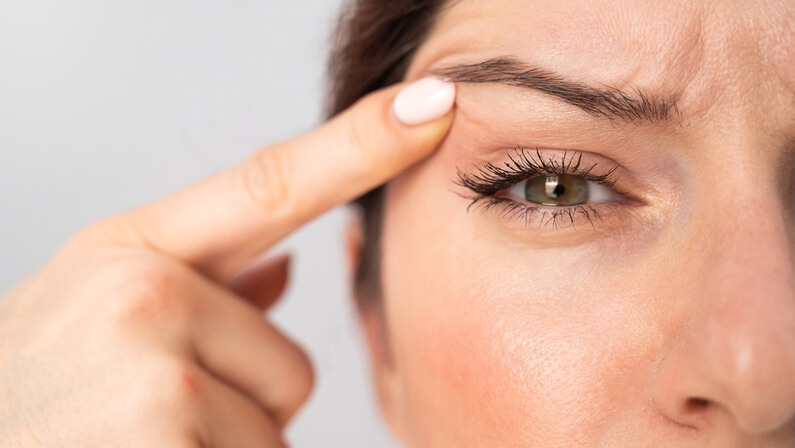 saggy eyelid discomfort problem