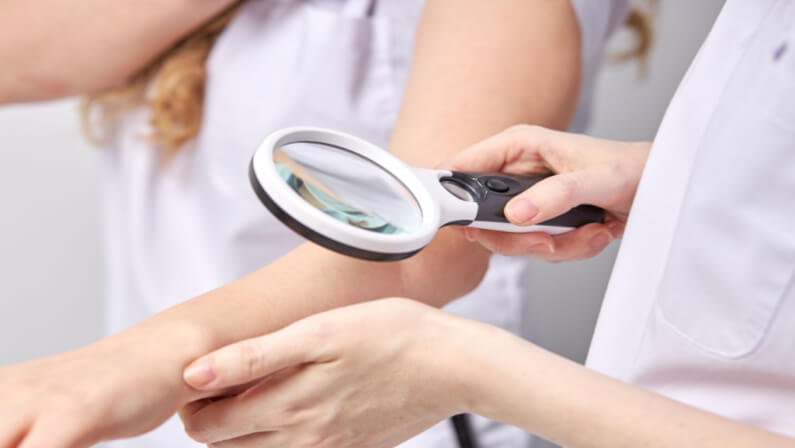 dermatologist examining patient for a possible ichthyosis